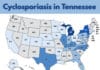 Cyclosporiasis Cases Climb in Tennessee as Nationwide Illnesses Continue to Rise